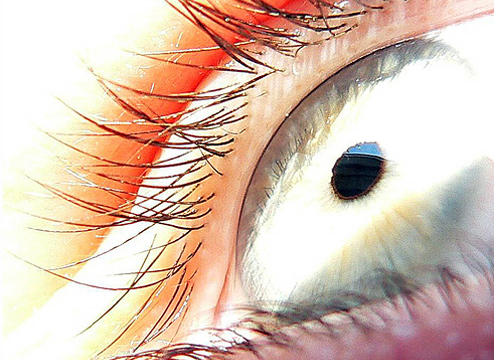 Глазная клиника Терезиенхёе